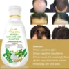 Anti-Hair Fall Anti Hair Loss Shampoo