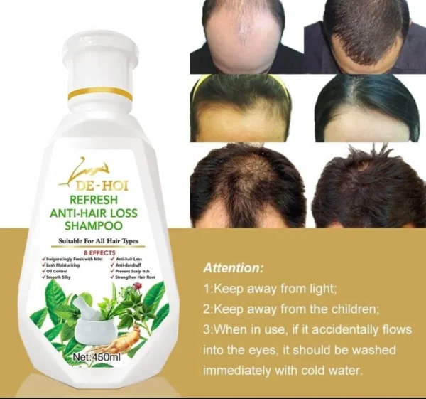 Anti-Hair Fall Anti Hair Loss Shampoo