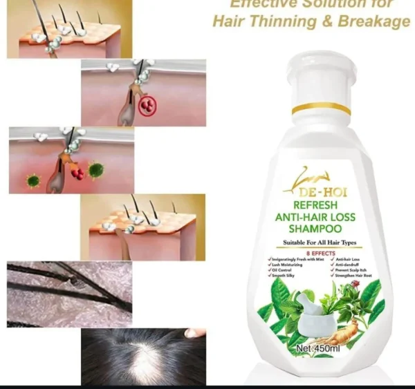 Anti-Hair Fall Anti Hair Loss Shampoo